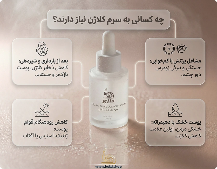 چه کسانی به سرم کلاژن نیاز دارند؟
